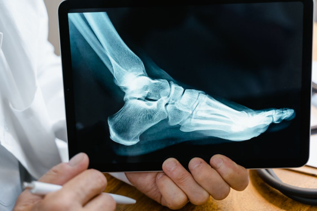 Workplace Injuries