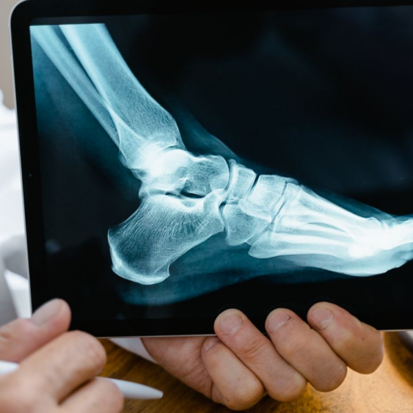 Workplace Injuries: When a Workers’ Comp Claim Isn’t Enough