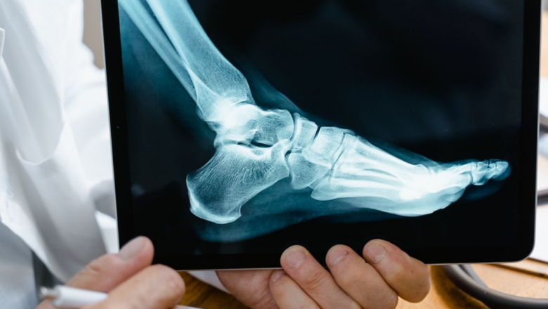 Workplace Injuries: When a Workers’ Comp Claim Isn’t Enough